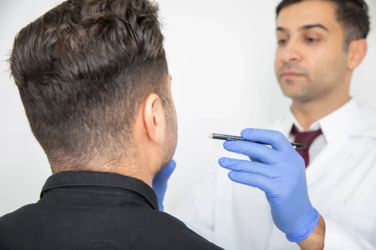 skäggtransplantation